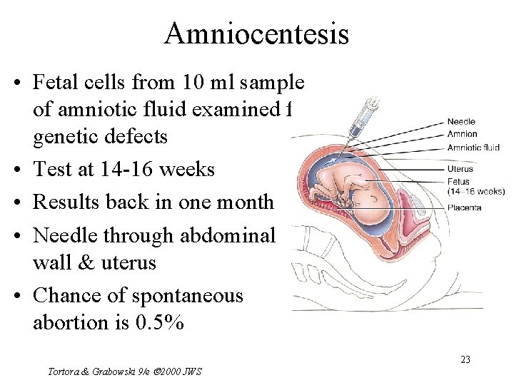 Amniocentesis • Fetal cells from 10 ml sample of amniotic fluid examined for genetic