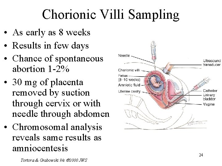 Chorionic Villi Sampling • As early as 8 weeks • Results in few days