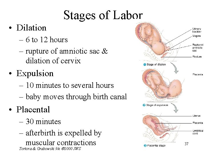 Stages of Labor • Dilation – 6 to 12 hours – rupture of amniotic