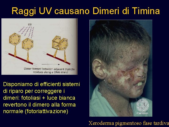 Raggi UV causano Dimeri di Timina Disponiamo di efficienti sistemi di riparo per correggere