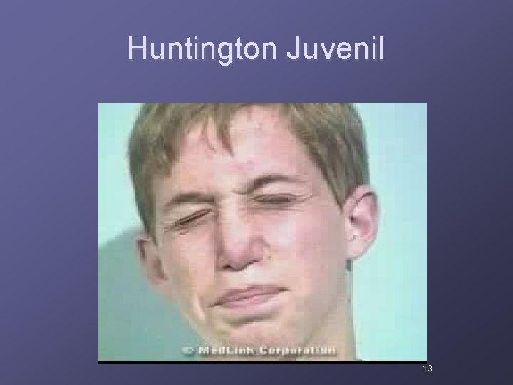 Huntington Juvenil 13 