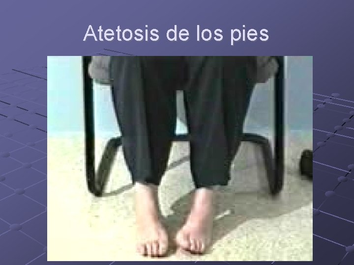 Atetosis de los pies 16 