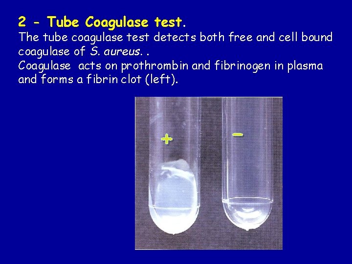 2 - Tube Coagulase test. The tube coagulase test detects both free and cell