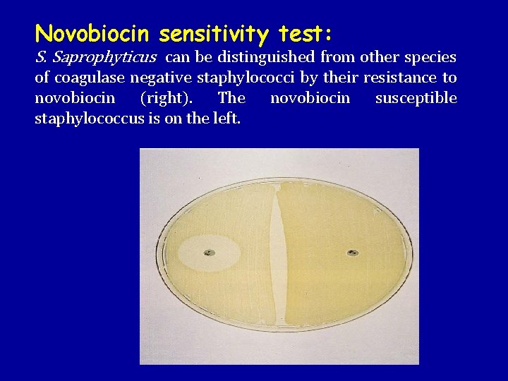 Novobiocin sensitivity test: S. Saprophyticus can be distinguished from other species of coagulase negative