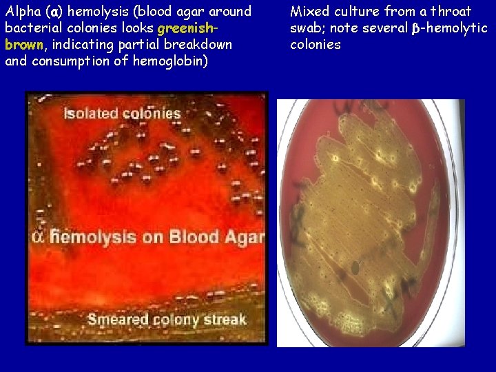 Alpha (α) hemolysis (blood agar around bacterial colonies looks greenishbrown, indicating partial breakdown and