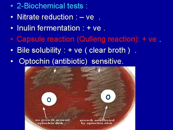  • • • 2 -Biochemical tests : Nitrate reduction : – ve. Inulin