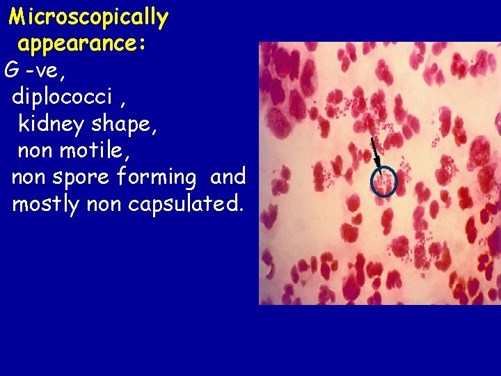 Microscopically appearance: G -ve, diplococci , kidney shape, non motile, non spore forming and