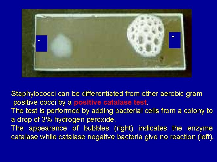 - + Staphylococci can be differentiated from other aerobic gram positive cocci by a