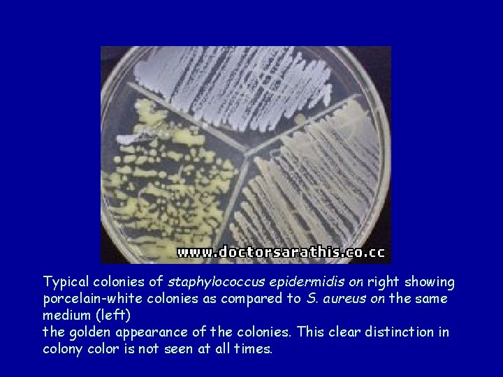 Typical colonies of staphylococcus epidermidis on right showing porcelain-white colonies as compared to S.