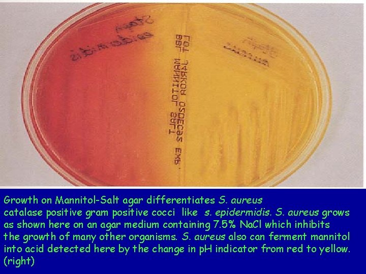 Growth on Mannitol-Salt agar differentiates S. aureus catalase positive gram positive cocci like s.