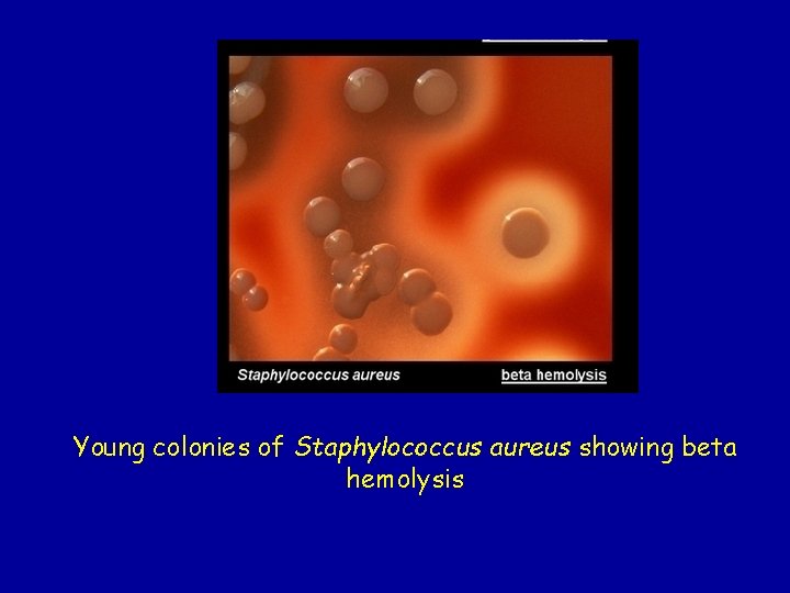 Young colonies of Staphylococcus aureus showing beta hemolysis 