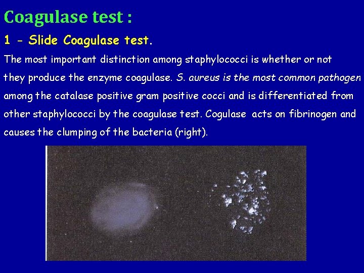 Coagulase test : 1 - Slide Coagulase test. The most important distinction among staphylococci