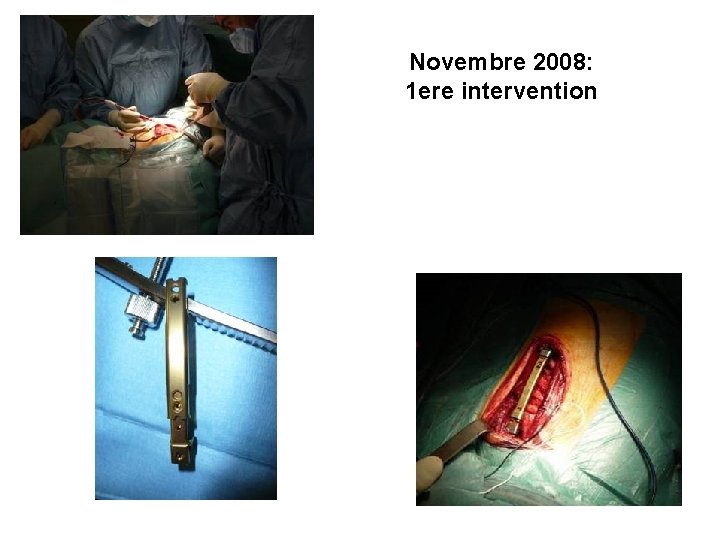 Novembre 2008: 1 ere intervention 