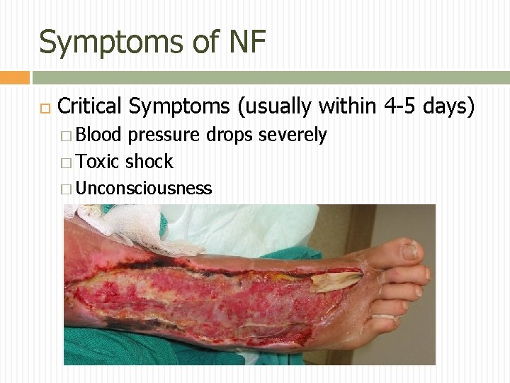 Symptoms of NF Critical Symptoms (usually within 4 -5 days) � Blood pressure drops