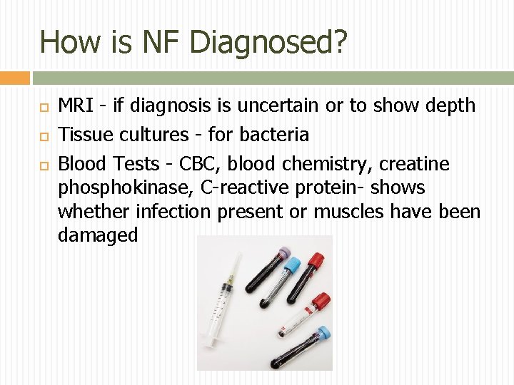 How is NF Diagnosed? MRI - if diagnosis is uncertain or to show depth