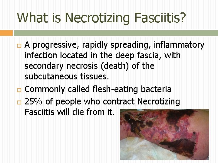What is Necrotizing Fasciitis? A progressive, rapidly spreading, inflammatory infection located in the deep