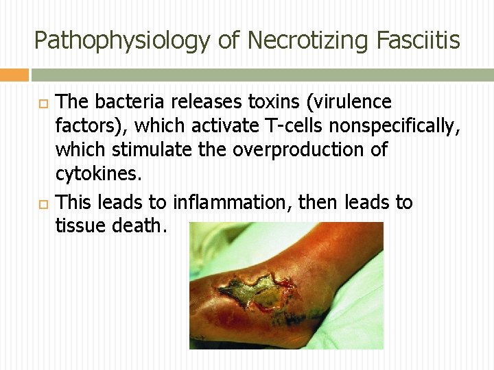 Pathophysiology of Necrotizing Fasciitis The bacteria releases toxins (virulence factors), which activate T-cells nonspecifically,
