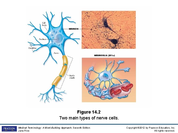 Figure 14. 2 Two main types of nerve cells. Medical Terminology: A Word-Building Approach, Figure 14. 2 Two main types of nerve cells. Medical Terminology: A Word-Building Approach,