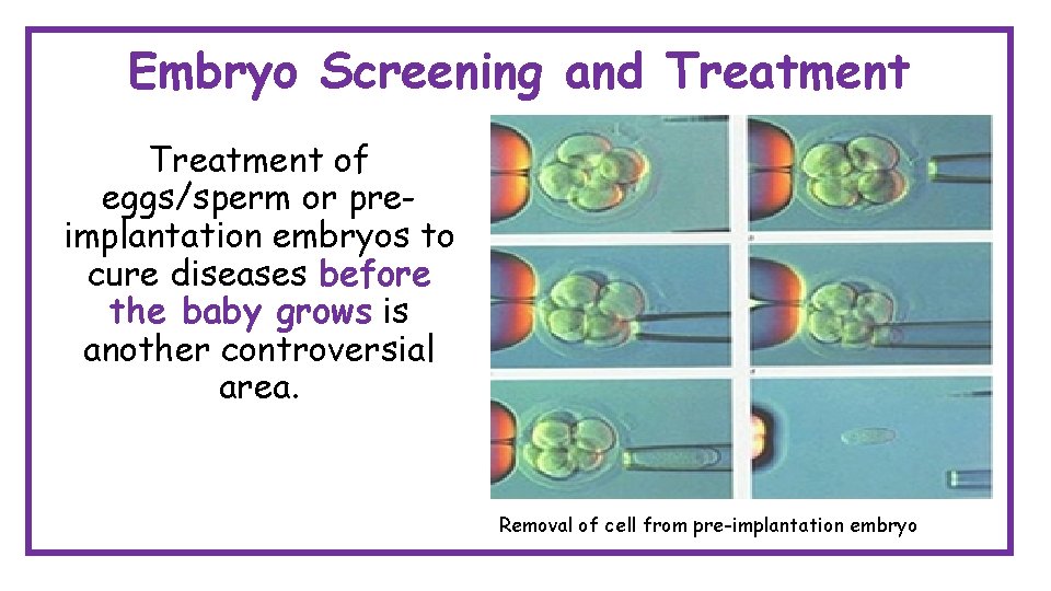 Embryo Screening and Treatment of eggs/sperm or preimplantation embryos to cure diseases before the Embryo Screening and Treatment of eggs/sperm or preimplantation embryos to cure diseases before the