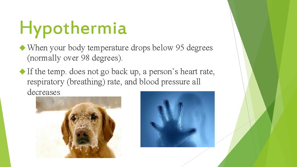Hypothermia When your body temperature drops below 95 degrees (normally over 98 degrees). If