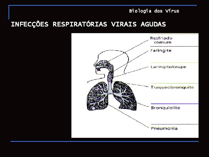 Biologia dos Vírus INFECÇÕES RESPIRATÓRIAS VIRAIS AGUDAS 