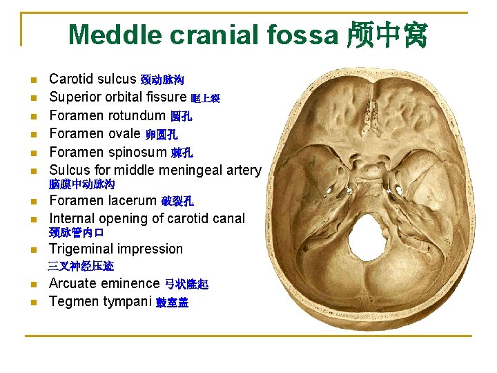 Meddle cranial fossa 颅中窝 n n n Carotid sulcus 颈动脉沟 Superior orbital fissure 眶上裂 Meddle cranial fossa 颅中窝 n n n Carotid sulcus 颈动脉沟 Superior orbital fissure 眶上裂