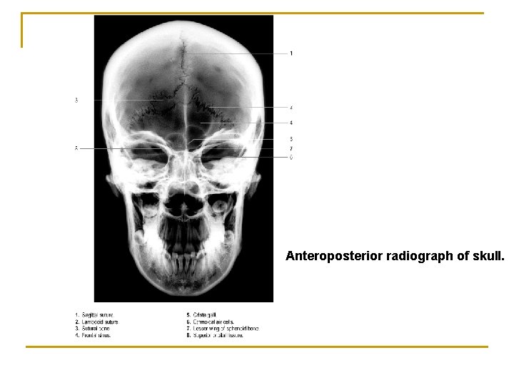 Anteroposterior radiograph of skull. 