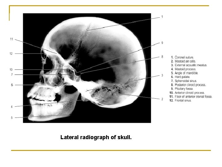 Lateral radiograph of skull. 