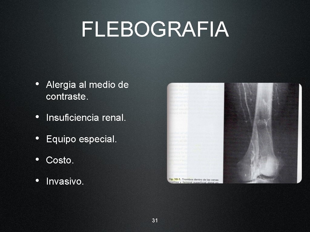 FLEBOGRAFIA • Alergia al medio de contraste. • Insuficiencia renal. • Equipo especial. •