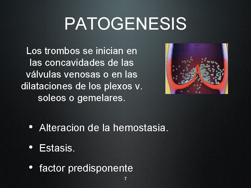 PATOGENESIS Los trombos se inician en las concavidades de las válvulas venosas o en