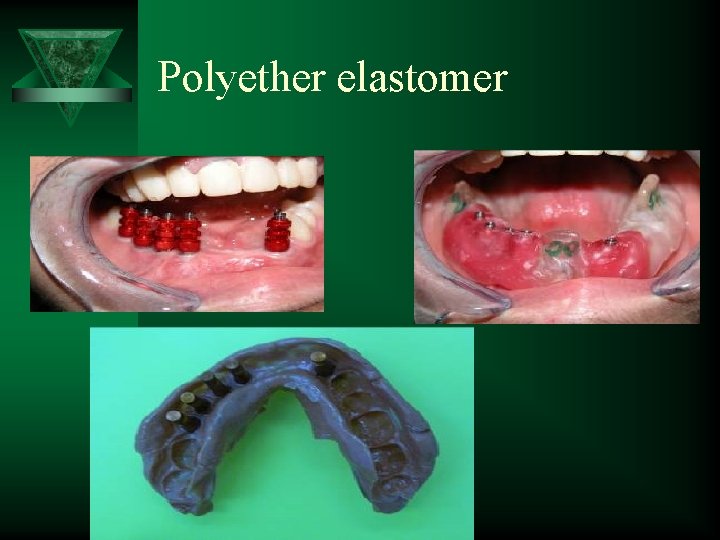 Polyether elastomer 