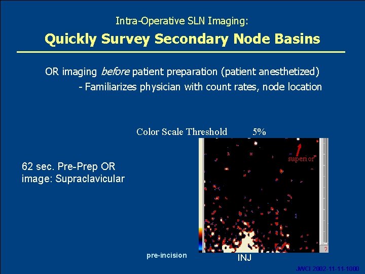 Intra-Operative SLN Imaging: Quickly Survey Secondary Node Basins OR imaging before patient preparation (patient