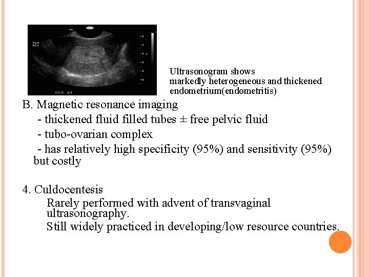 Ultrasonogram shows markedly heterogeneous and thickened endometrium(endometritis) B. Magnetic resonance imaging - thickened fluid