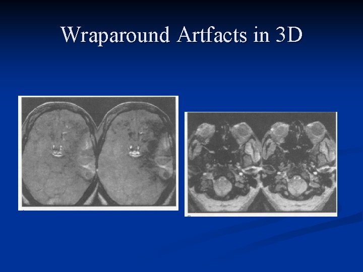 Wraparound Artfacts in 3 D 