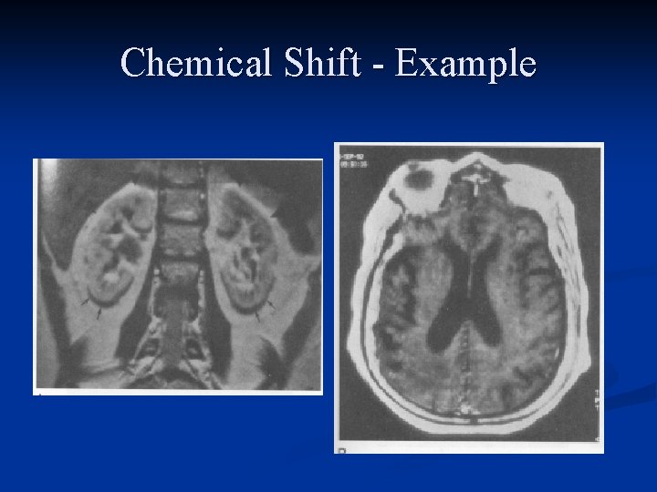 Chemical Shift - Example 