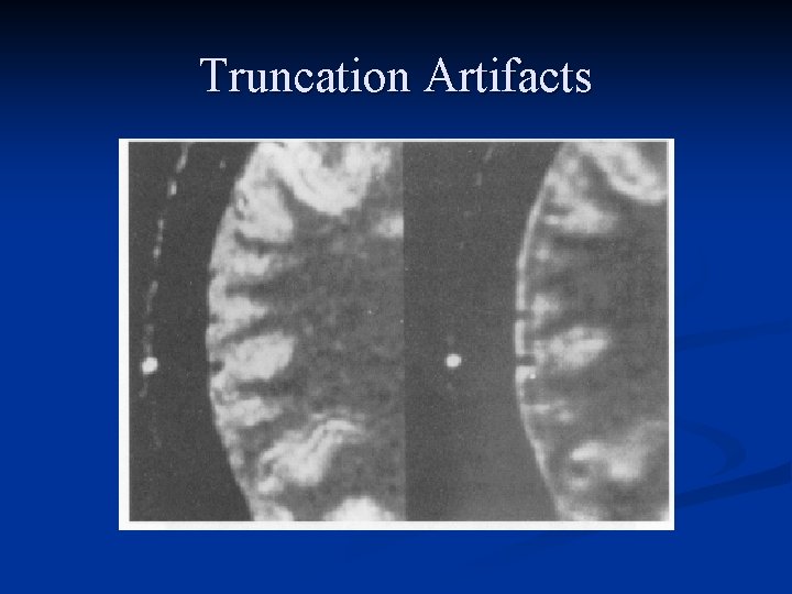 Truncation Artifacts 