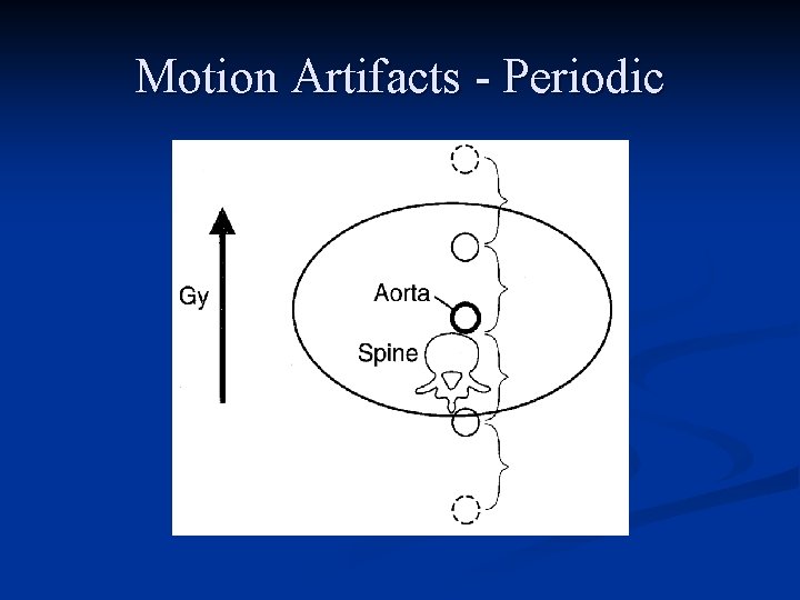 Motion Artifacts - Periodic 