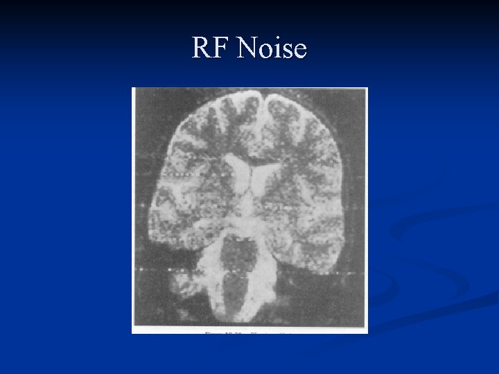 RF Noise 