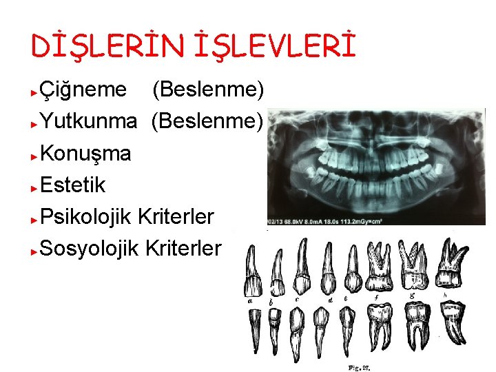 DİŞLERİN İŞLEVLERİ Çiğneme (Beslenme) ►Yutkunma (Beslenme) ►Konuşma ►Estetik ►Psikolojik Kriterler ►Sosyolojik Kriterler ► 