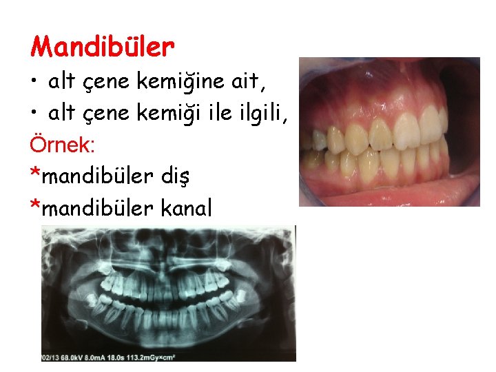 Mandibüler • alt çene kemiğine ait, • alt çene kemiği ile ilgili, Örnek: *mandibüler