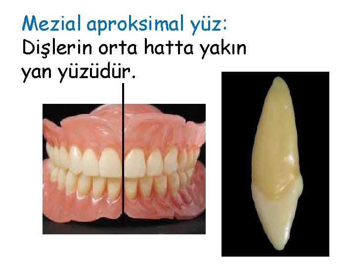 Mezial aproksimal yüz: Dişlerin orta hatta yakın yan yüzüdür. 