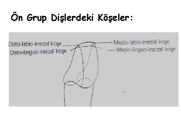 Ön Grup Dişlerdeki Köşeler: 