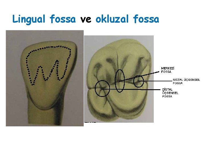 Lingual fossa ve okluzal fossa 