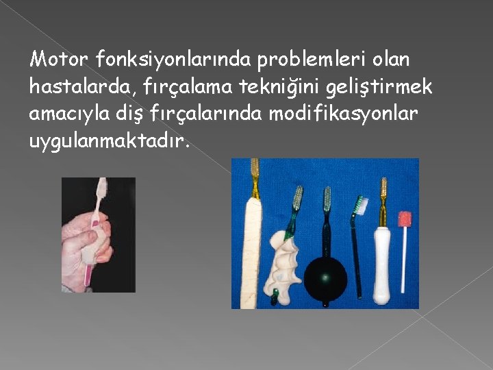 Motor fonksiyonlarında problemleri olan hastalarda, fırçalama tekniğini geliştirmek amacıyla diş fırçalarında modifikasyonlar uygulanmaktadır. 