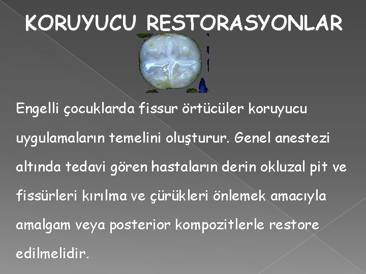 KORUYUCU RESTORASYONLAR Engelli çocuklarda fissur örtücüler koruyucu uygulamaların temelini oluşturur. Genel anestezi altında tedavi