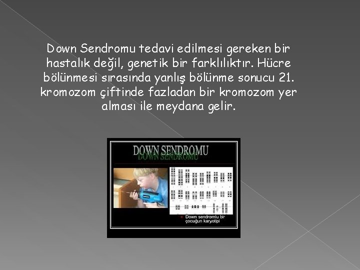 Down Sendromu tedavi edilmesi gereken bir hastalık değil, genetik bir farklılıktır. Hücre bölünmesi sırasında