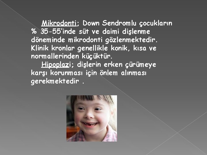 Mikrodonti; Down Sendromlu çocukların % 35 -55’inde süt ve daimi dişlenme döneminde mikrodonti gözlenmektedir.