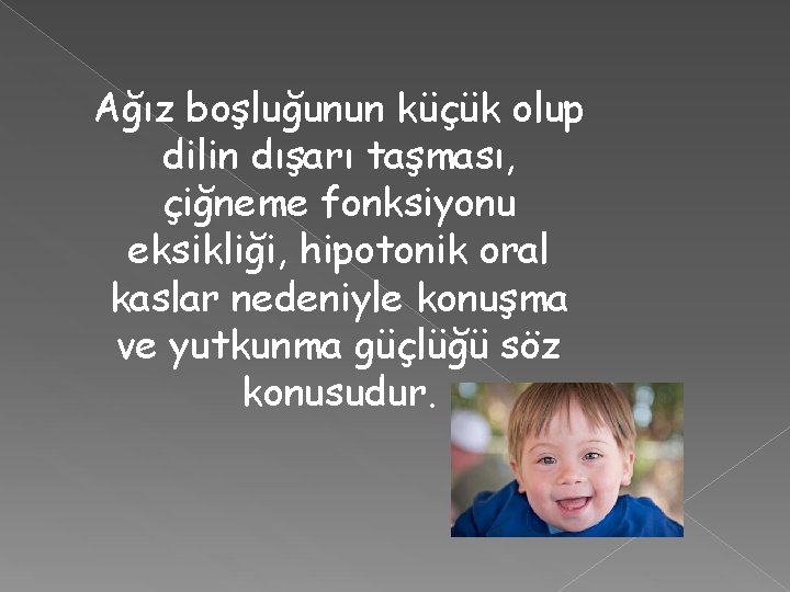 Ağız boşluğunun küçük olup dilin dışarı taşması, çiğneme fonksiyonu eksikliği, hipotonik oral kaslar nedeniyle