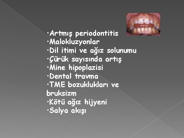  • Artmış periodontitis • Malokluzyonlar • Dil itimi ve ağız solunumu • Çürük