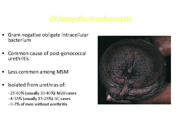 Chlamydia trachomatis • Gram negative obligate intracellular bacterium • Common cause of post-gonococcal urethritis